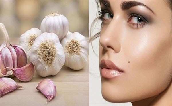 10 Cách Xóa Nốt Ruồi Tại Nhà Đơn Giản An Toàn Nhất