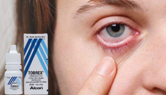 Dung dịch nhỏ mắt Tobrex có tác dụng gì? Cách sử dụng và giá bán?