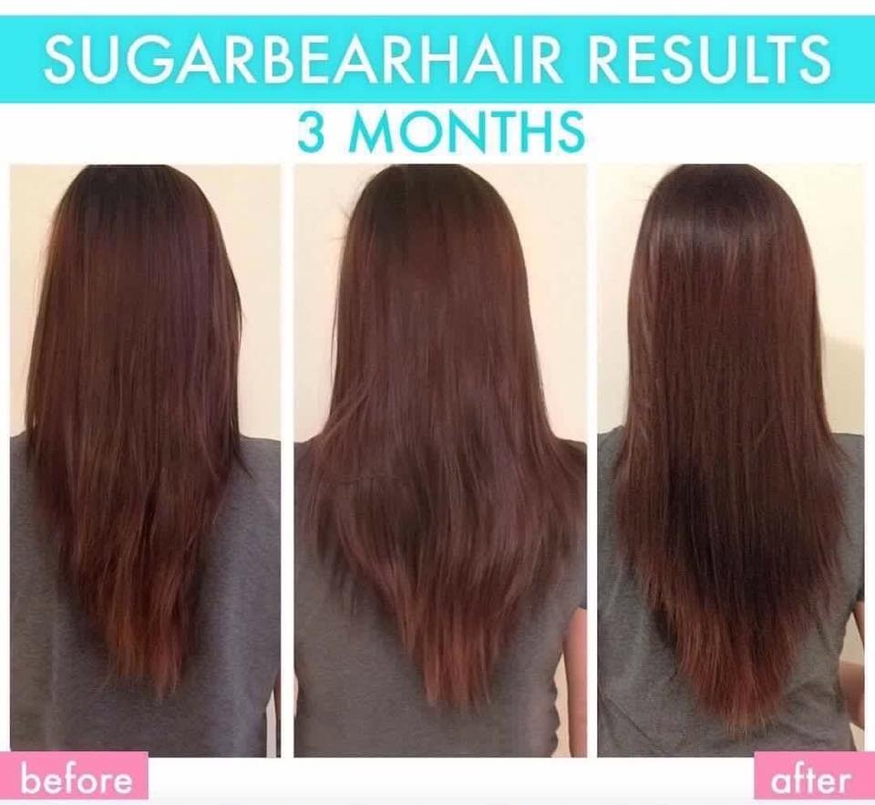Kẹo Gấu Sugar Bear Hair – Hỗ Trợ Tóc Mọc Nhanh