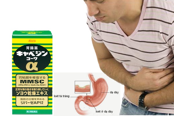 Viên Uống Kyabeijin Mmsc Kowa Của Nhật 300 Viên