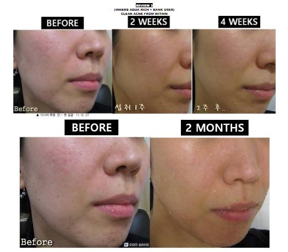 Viên Uống Hỗ Trợ Cấp Nước Bổ Sung Collage Aqua Rich Innerb