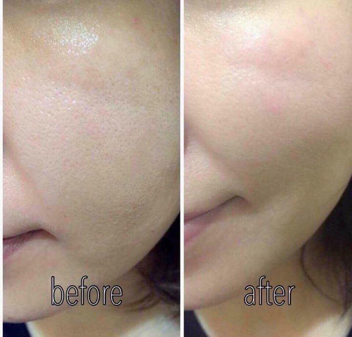 Viên Uống Hỗ Trợ Cấp Nước Bổ Sung Collage Aqua Rich Innerb