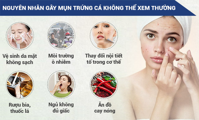 Mụn Trứng Cá Có Mấy Loại, Phương Pháp Điều Trị Nào Hiệu Quả Nhất?