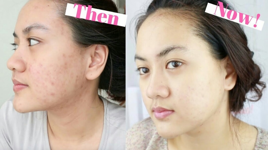 Serum Dưỡng Trắng The Ordinary Alpha Arbutin 2 + HA Canada