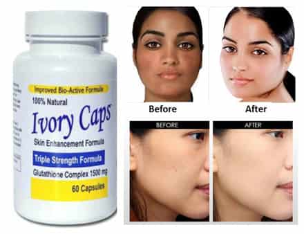 Chị Em Đã Ai Dùng Viên Uống Trắng Da Ivory Caps Chưa Ạ? Có An Toàn Không?